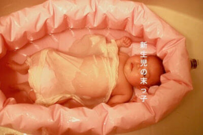 新生児の乳酸菌沐浴